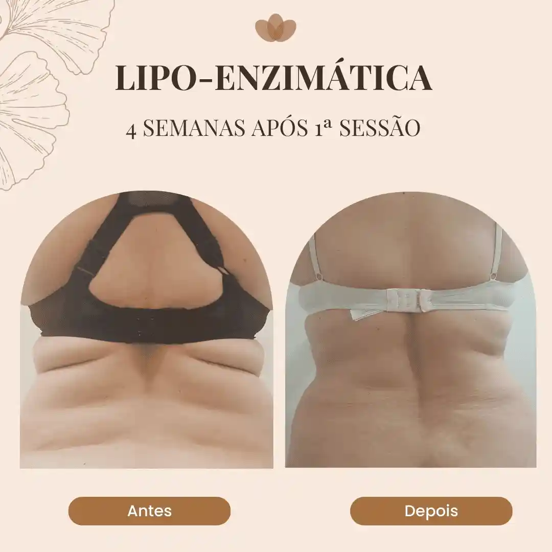 a83e501f-fbc6-4dac-bca9-40b665e643a0_11_11zon